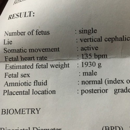 Mga mamsh ok lang bayung weight ni baby sa 7months ?