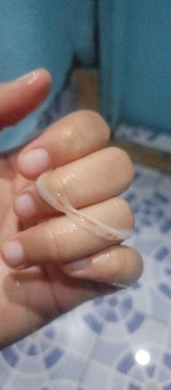 maaf terlihat jorok, ini flek saya barusan saat bak selesai hb, ada yang pernah ngalamin ga?