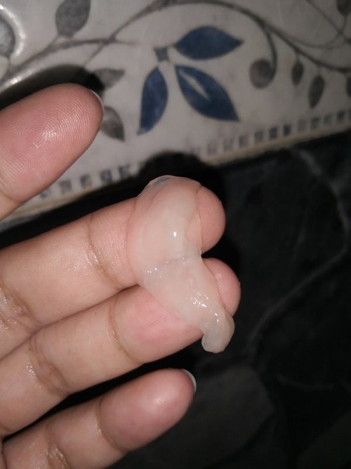 Mucus plug naba ito?