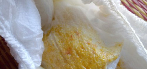 ถ่ายปนมูกเลือด