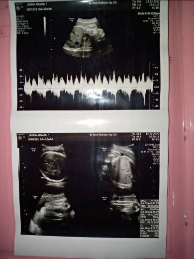 apakah jenis kelamin perempuan