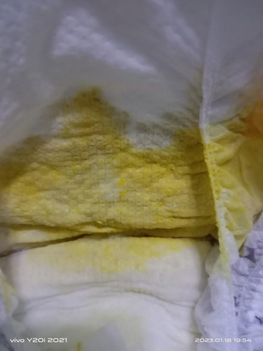 Hello, bkit po parang tubig Ang poop ni baby, 3weeks old , breastfeed po xa,normal lang po ba yan.