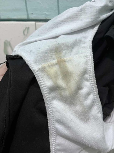 Yellowish to brownish discharge