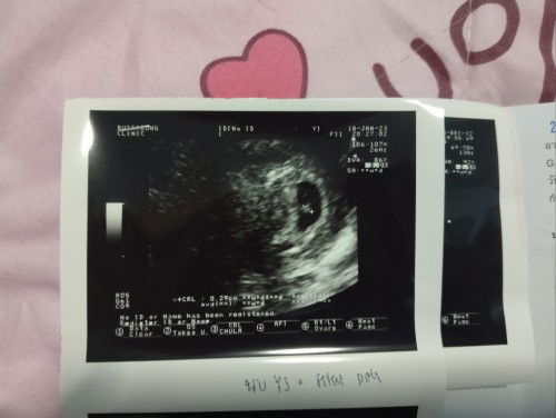 แม่ๆเจอตัวน้องกี่สัปดาห์ค่ะ