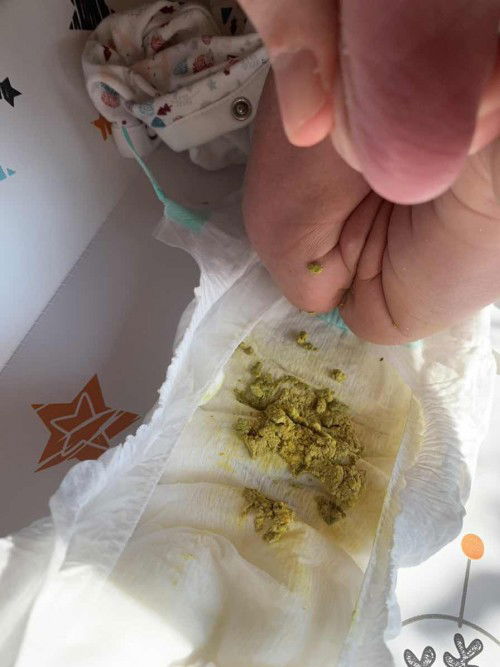 น้องอายุ 2 อาทิตย์ ถ่ายแบบนี้ปกติมั้ยคะ