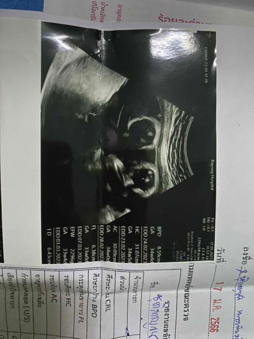 สอบถามค่ะ ผู้หญิง/ผู้ชายคะ?