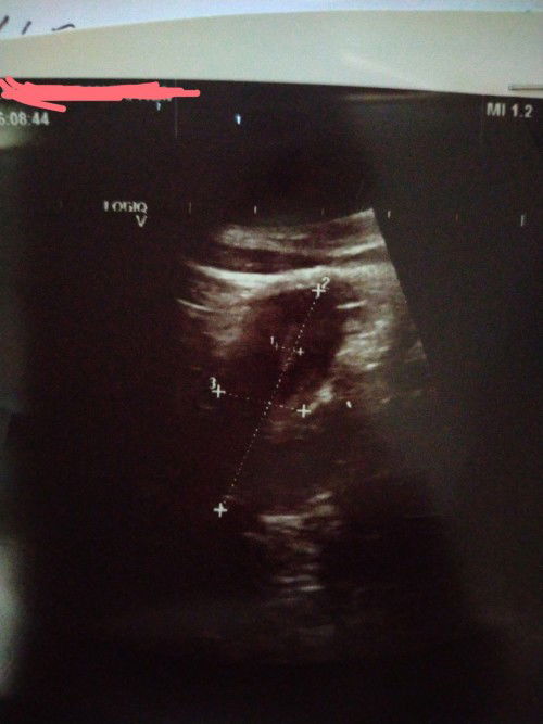 Ada sesiapa yg sama kes mcm sy x?