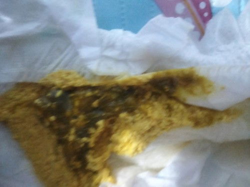 BAB bayi umur 28 hari