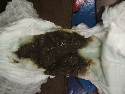 hi momshies ask ko lang po kung normal ba yan Nan Al110 milk nya.  2days ganyan worried ako.pls help