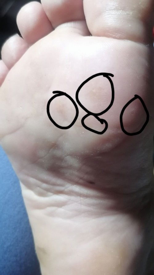 Sobrang kati ng paa, 😭