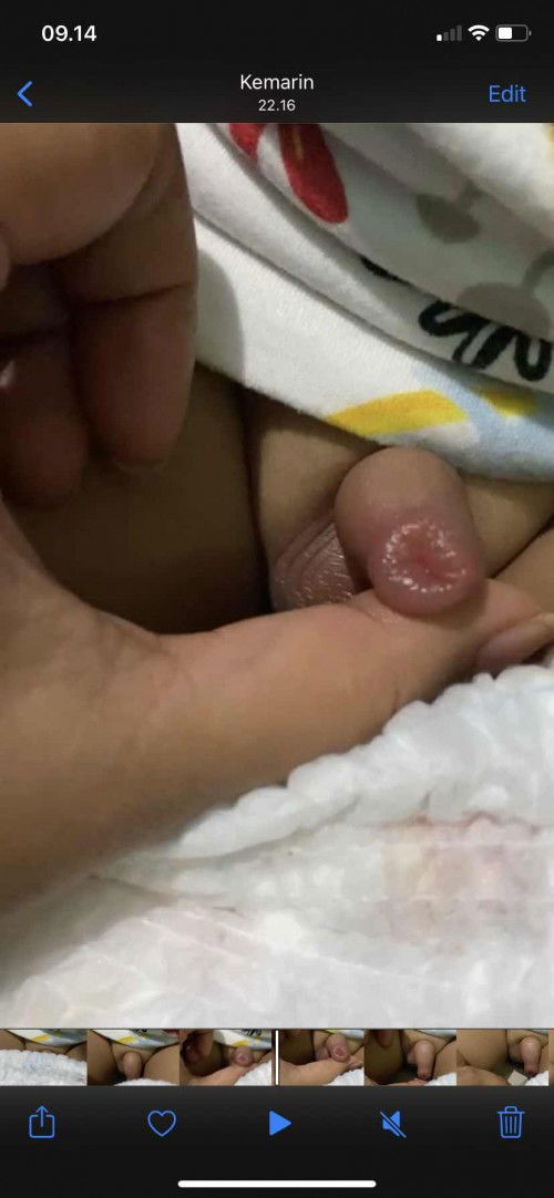 Bengkak pada kelamin