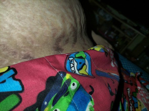 38 week 4d