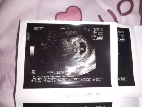 น้อง9wปกติไหมคะ