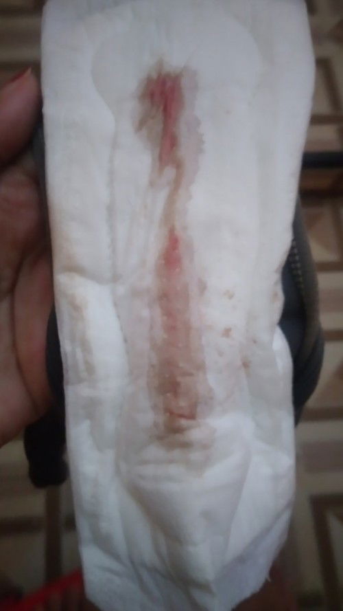 keluar darah UK 40W5D