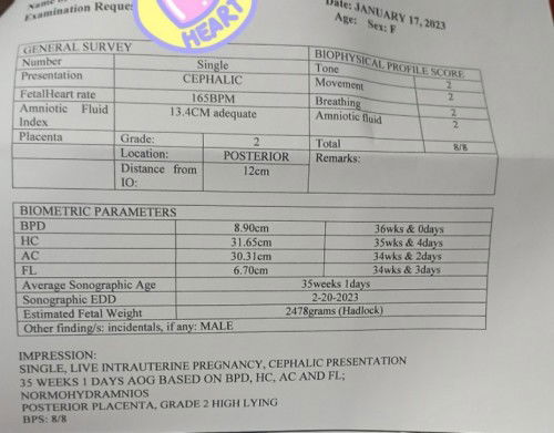 35 weeks breech to cephalic ♥️
