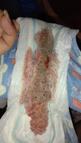 spotting or bleeding?