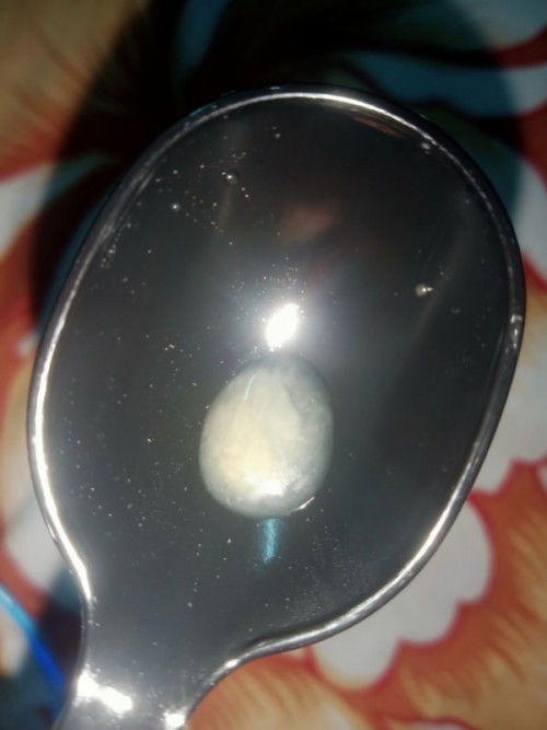 ท้อง32+4เดือนมีน้ำไหลออกจากหัวนม ใช่น้ำนมมั้ยคะ