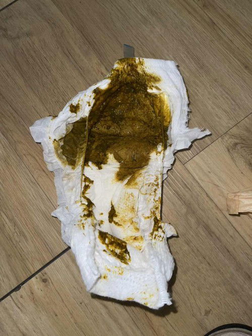 ถ่ายแบบนี้ปกติมั้ยคะ