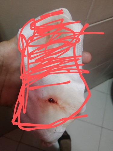 Is this Normal spot 1stTrimester
Umiinom na po ako pampakapit