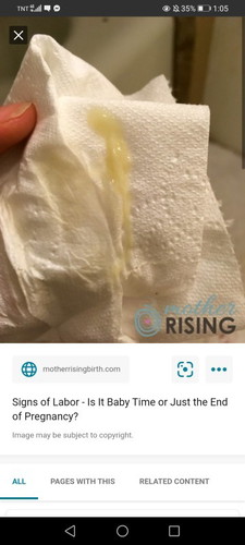 4days na ako sa ospital pwede parin ba ako manganak ng wala abot sa 1week kahit yellow mucus plug