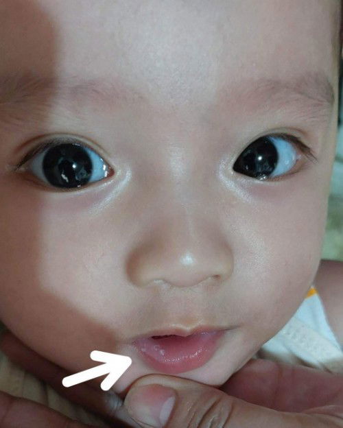 Mamumuong gatas sa labi ni baby