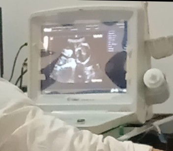 semoga lancar sampai persalinan