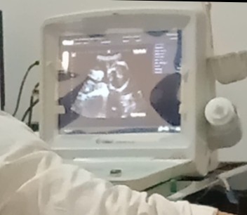 semoga lancar sampai persalinan