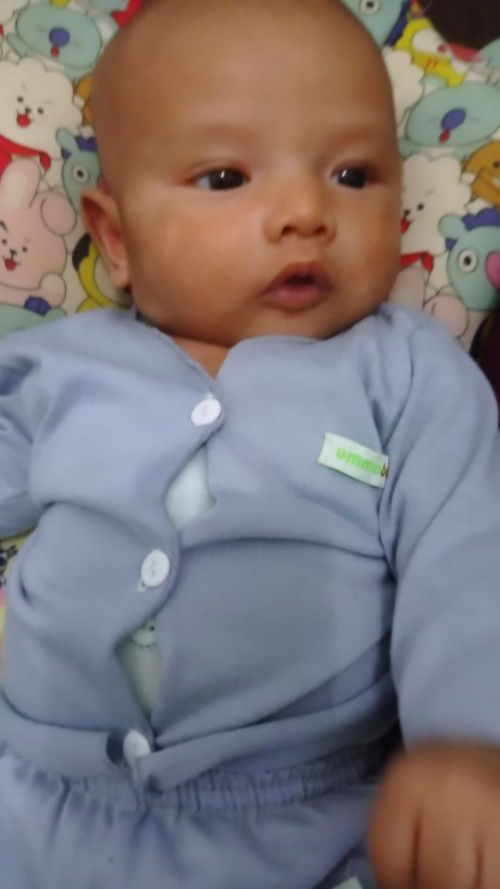 Bercak putih pada wajah bayi bagaimana cara menghilangkan nya?