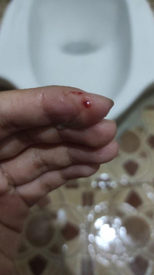 Flek trimester pertama