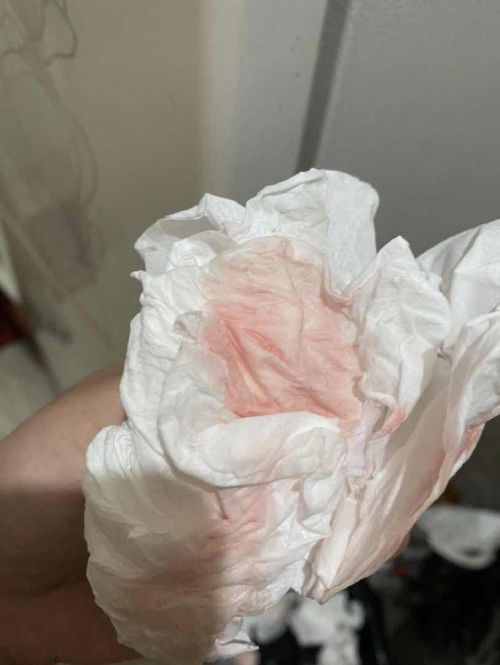 Darah Segar 38w6d tp dicek belum pembukaan