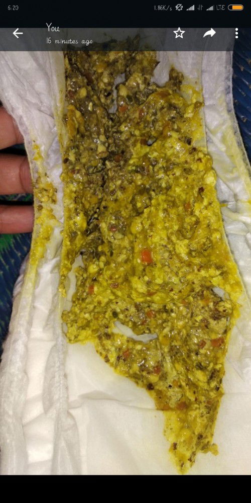 pup bayi 8 bulan apa ini normal