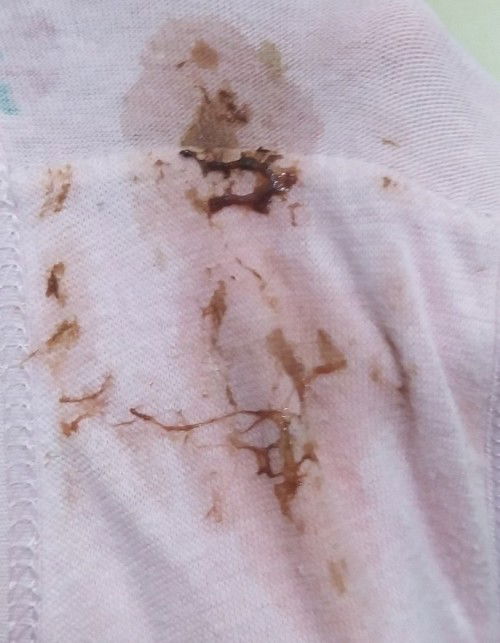 Keluar Kecoklatan di 5W 5D