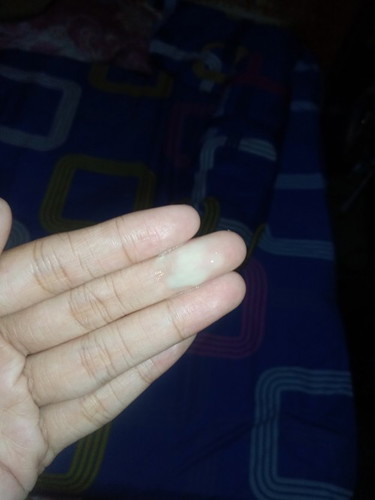 Tnya donk bund