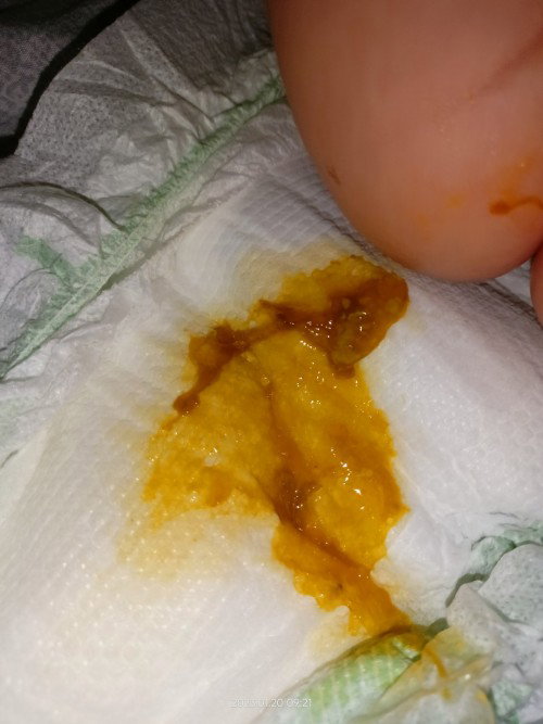 4months old Cold