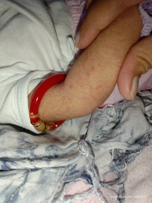 Ano po ito? Need answer po