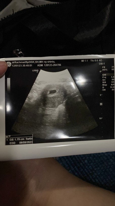 Masuk 7w hamil ke 2 rasanya beda sekali