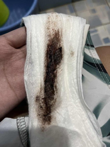 Regla kona Po na ito