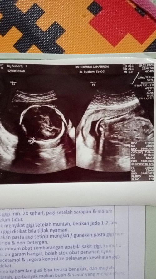 Dokter cuman jelaskan semuanya baik