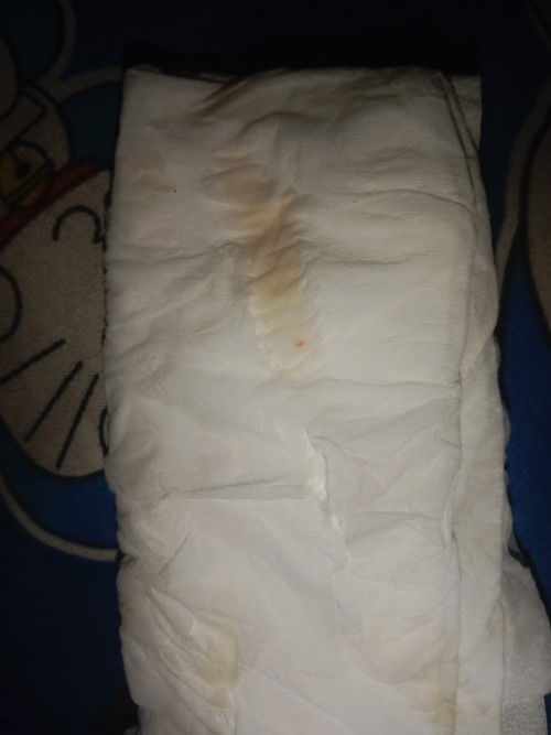 นัดผ่า26 มกราคม นี้