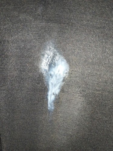 White Discharge