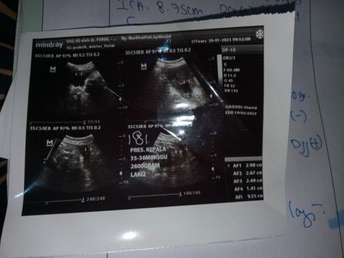 Alhamdulillah#masyaallahtabarakallah