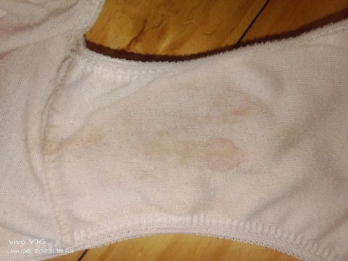 Implantation po ba eto?