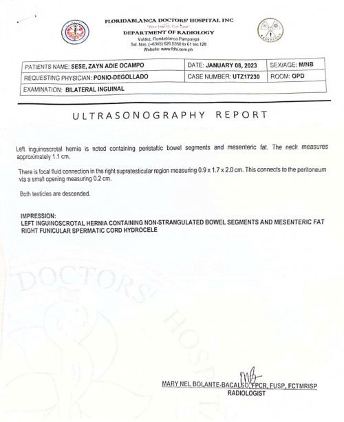 na niniwala b kayo n mgsasara ng kusa ang inguinal hernia 1month baby sya. gusto kc ng surgeon opera