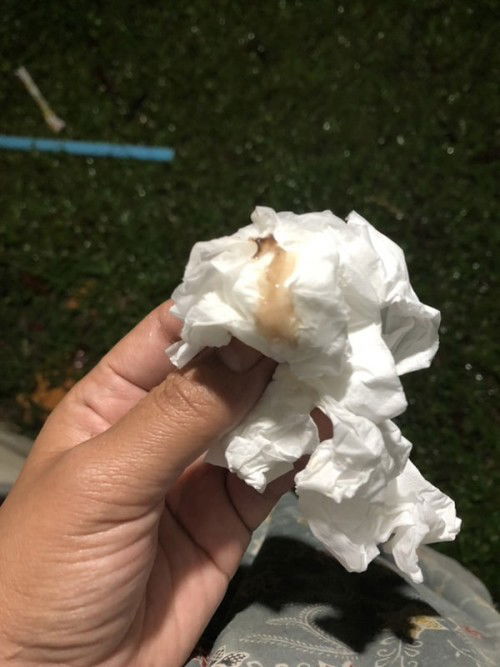 ท้อง39+6 อันนี้มูกเลือดมั้ยคะ