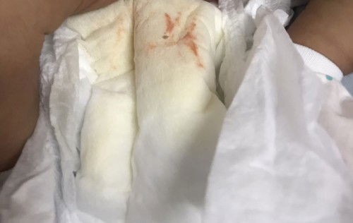 Bayi bru lahir 3 hari