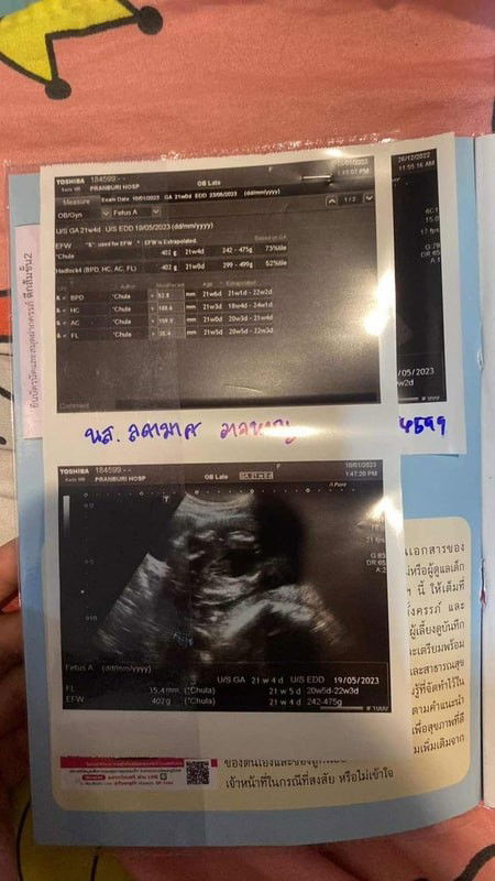 ชายหรือหญิงคะ แม่ๆช่วยดูทีค่ะ