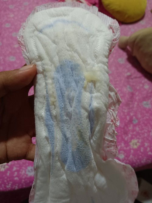 Normal ke keluar putih mcm tu sekali dgn air jernih ?