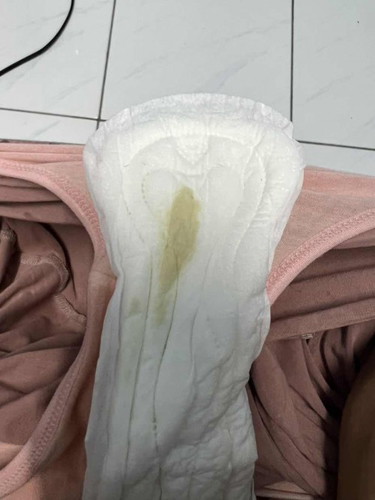 Darah nifas