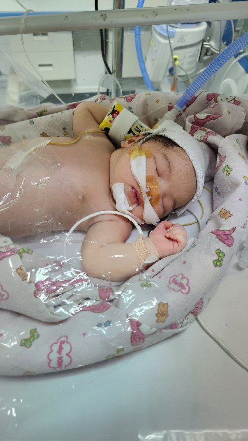 Alhamdulillah telah lahir putri kami