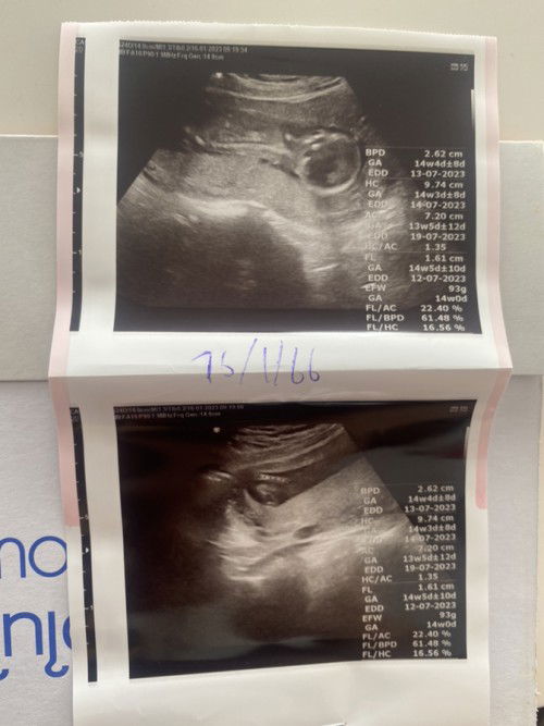 บำรุงอะไรถึงลงลูก